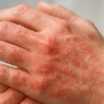 Egzama tamamen geçer mi