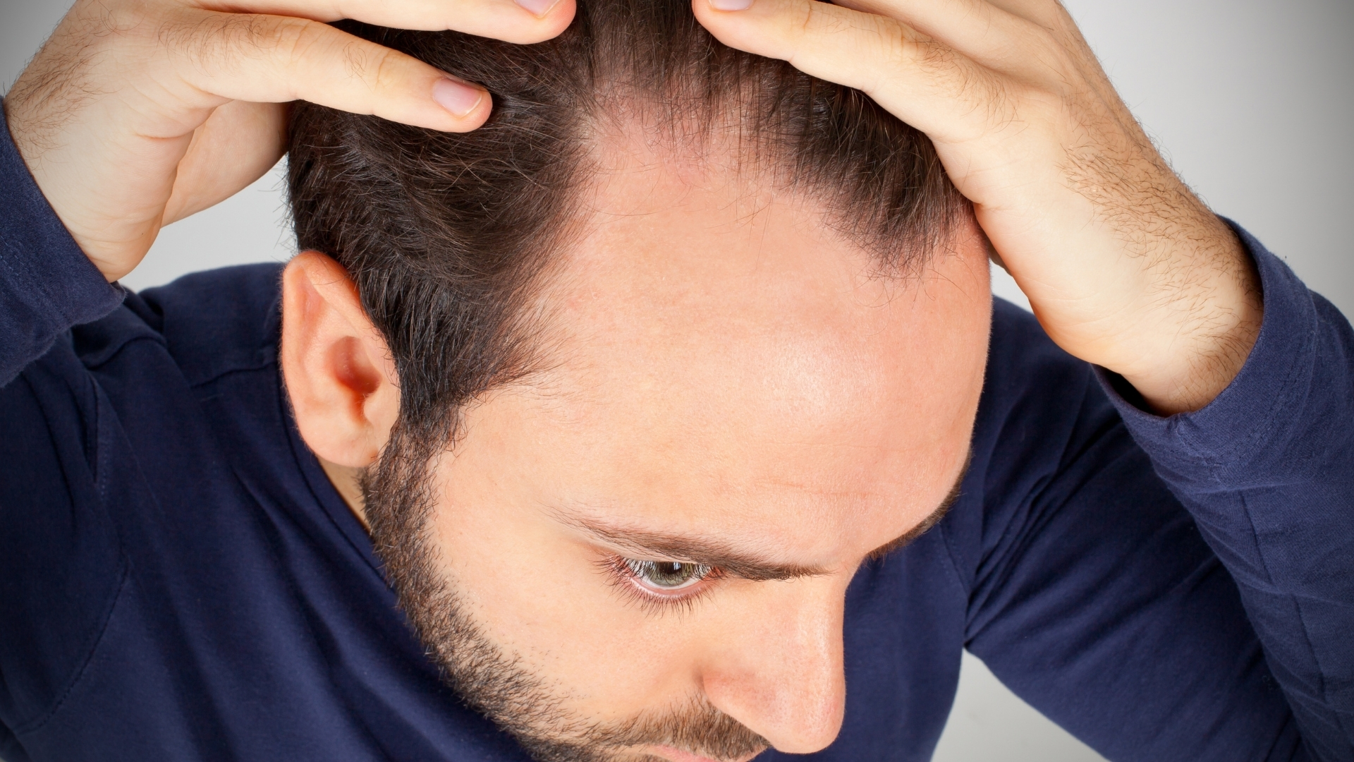 Saç Dökülmesi Tedavisi